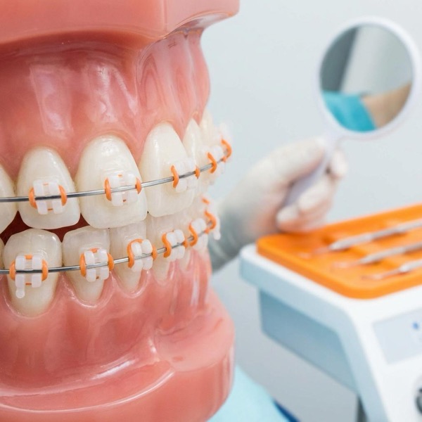 Sub Ortho Braces
